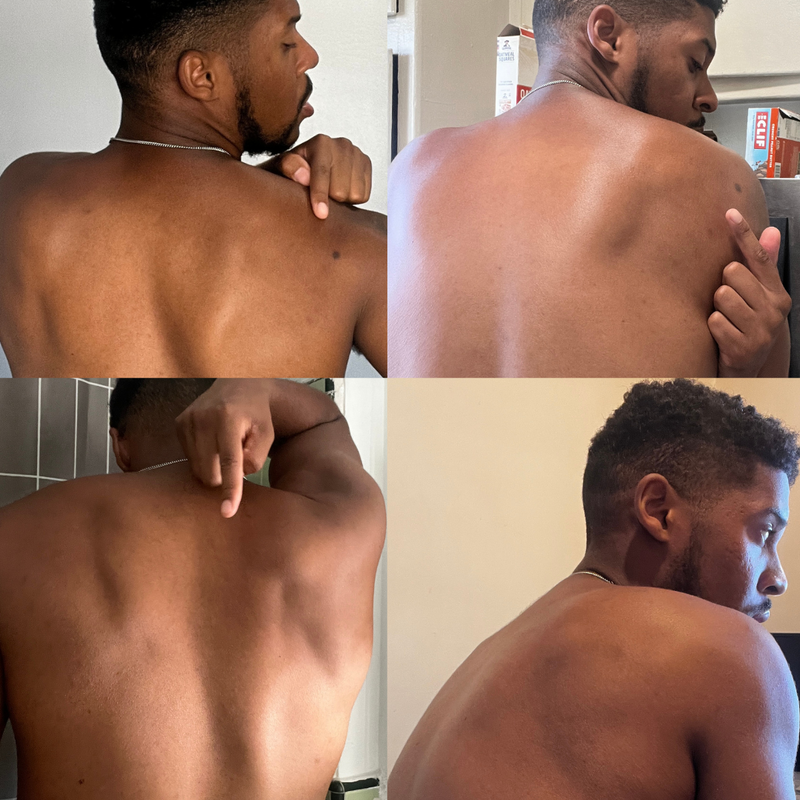 BioFormula Select  Kojic Acid Body Wash - Body Wash That Helps Lighten Dark Spots, Discoloration, Sun Spots, Age Spots & Post-Acne Marks, (1 pk, 30g)