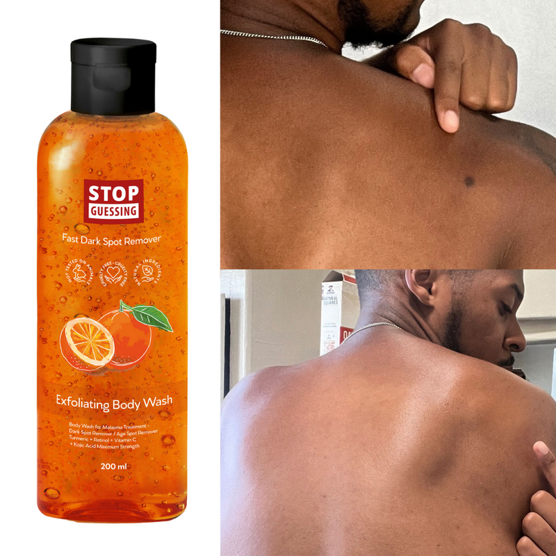 The Fast Dark Spot Remover Body Wash by Stop Guessing