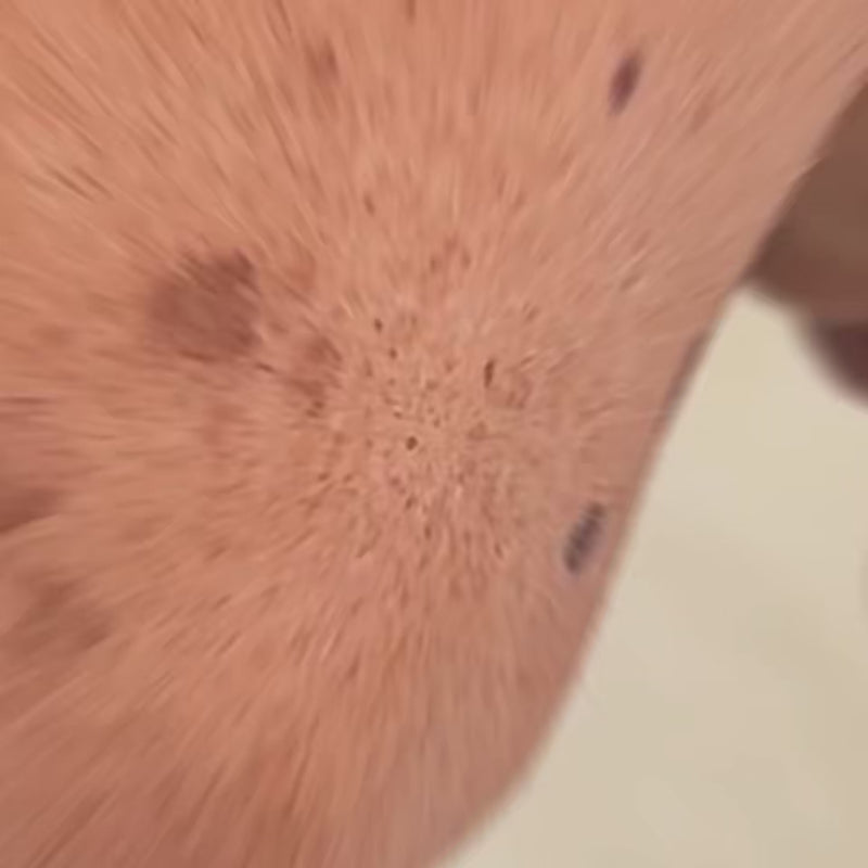 BioFormula Select  Kojic Acid Body Wash - Body Wash That Helps Lighten Dark Spots, Discoloration, Sun Spots, Age Spots & Post-Acne Marks, (1 pk, 30g)