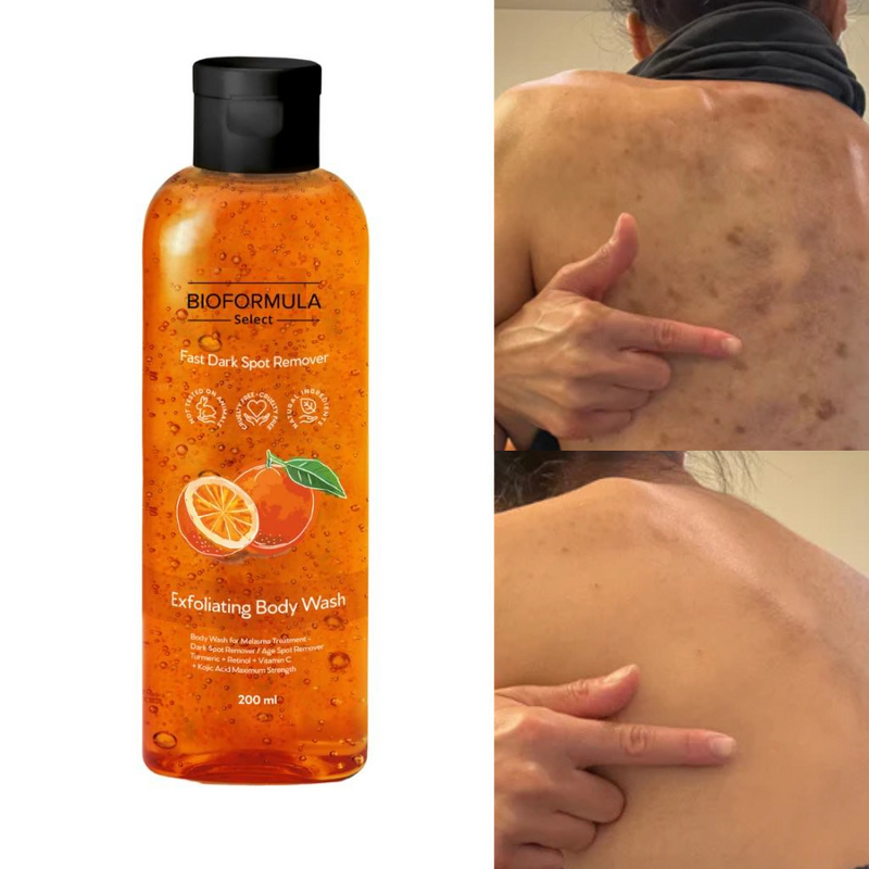 BioFormula Select  Kojic Acid Body Wash - Body Wash That Helps Lighten Dark Spots, Discoloration, Sun Spots, Age Spots & Post-Acne Marks, (1 pk, 30g)