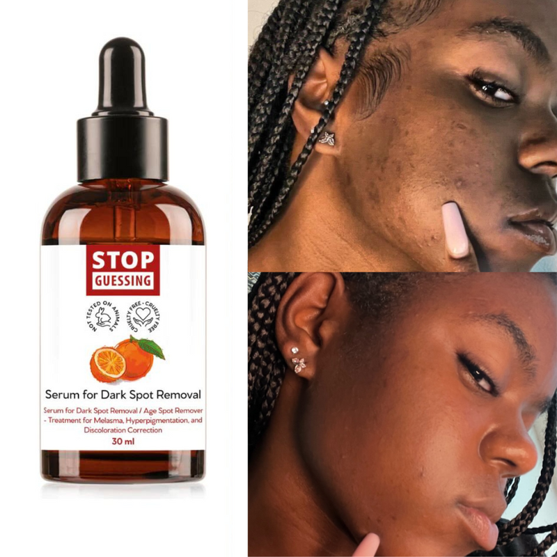 The Fast Dark Spot Remover Serum by Stop Guessing