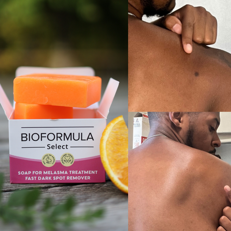 BioFormula Select Kojic Acid Dark Spot Remover Soap Bars with Vitamin C, Retinol, Collagen, Turmeric - Original Japanese Complex Infused with Hyaluronic Acid, Vitamin E, Shea Butter, Castile Olive Oil (2 Pack)